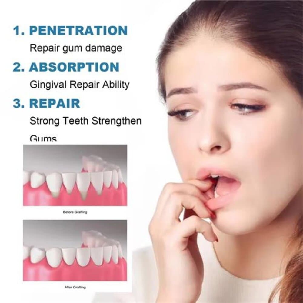 Rapid Repair Gums Serum Effectively Relieve Tooth Allergy Dental Caries Tooth - Thumbnail 4