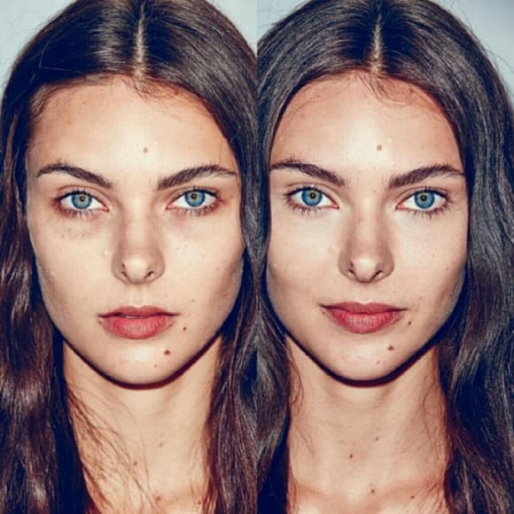 Severe Dark Circle Eye Remover - Thumbnail 6