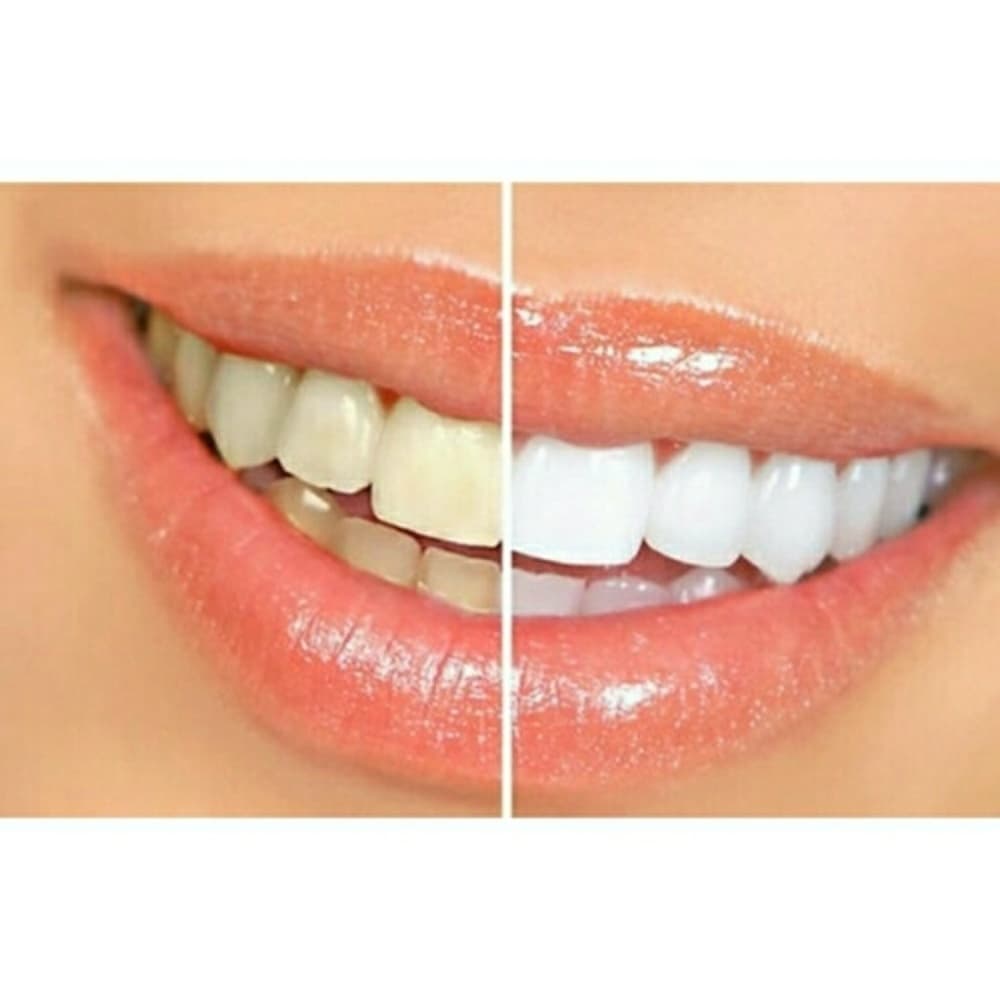 (1) Super White Teeth Pen- in 5 Days!!