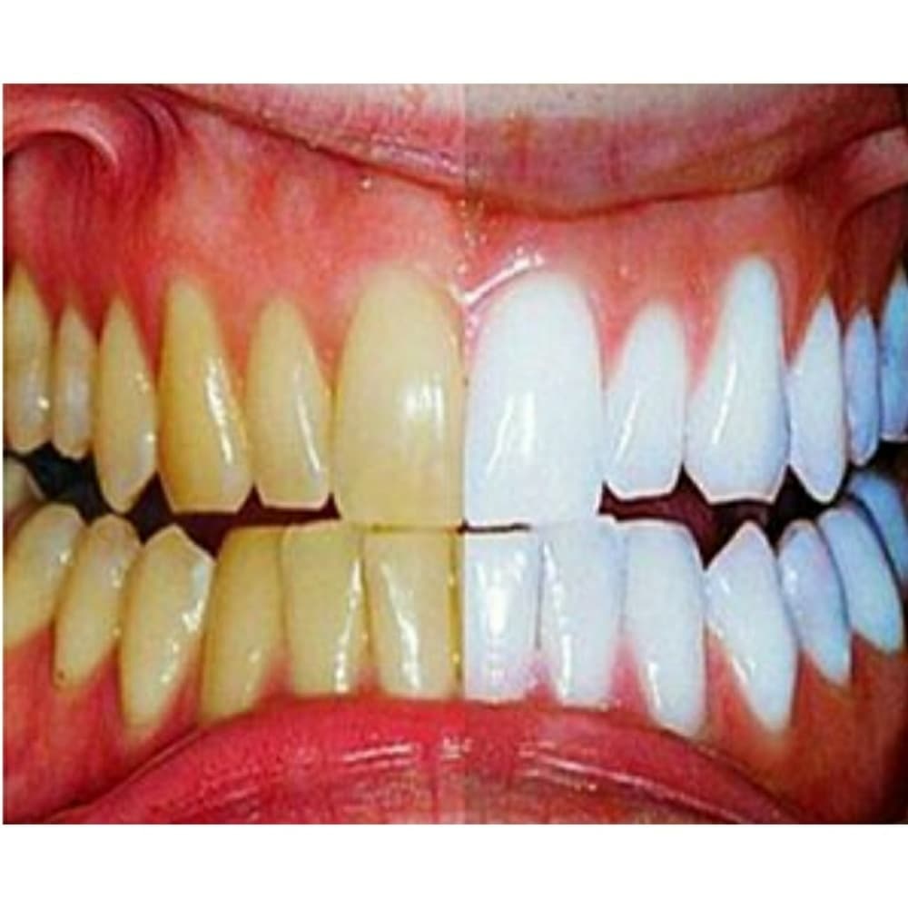(1) Super White Teeth Pen- in 5 Days!! - Thumbnail 6