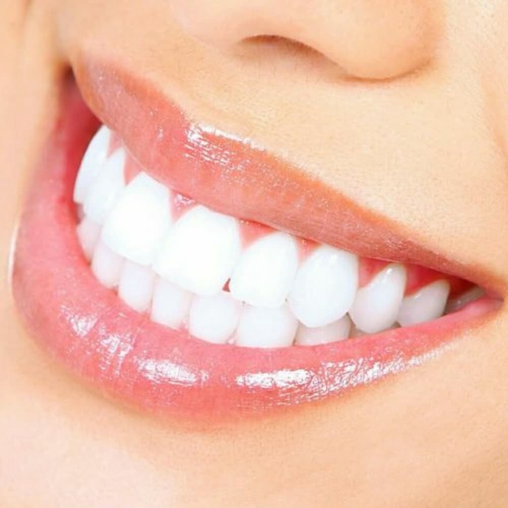 (1) Super White Teeth Pen- in 5 Days!! - Thumbnail 2