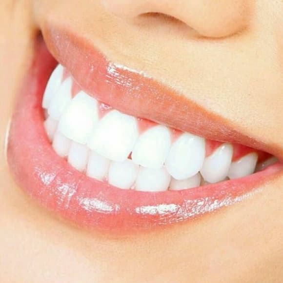 Natural White 5-Minute Teeth Whitening Kit! - Thumbnail 5