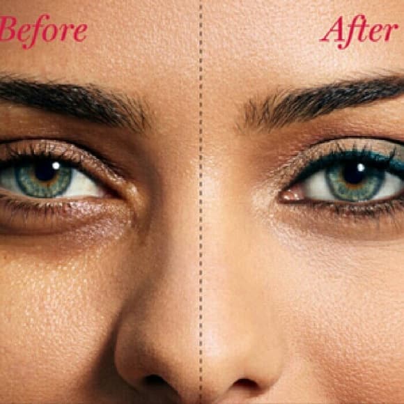 💖💖FLASH SALE Severe Dark Circle Eye Remover💖💖