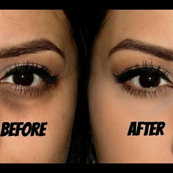 💖💖FLASH SALE Severe Dark Circle Eye Remover💖💖 - Thumbnail 2
