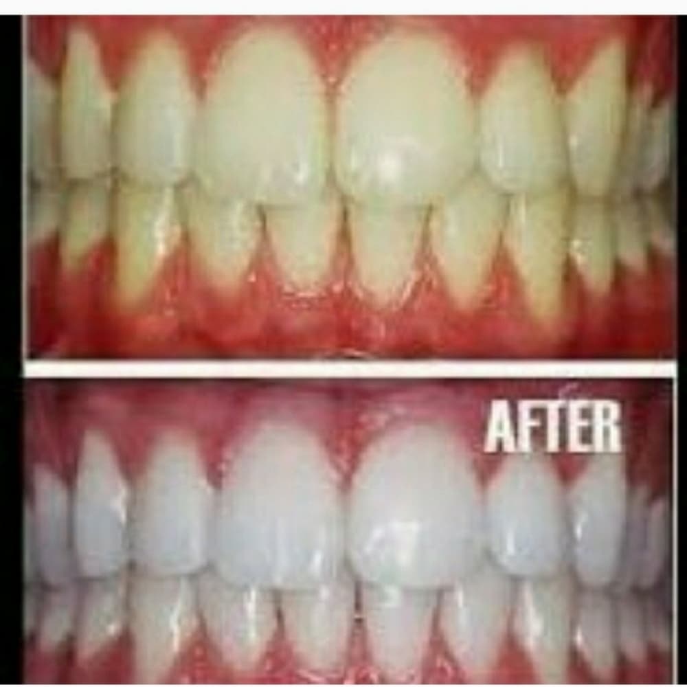 (2) Instant Teeth Whitening Pen - Thumbnail 4