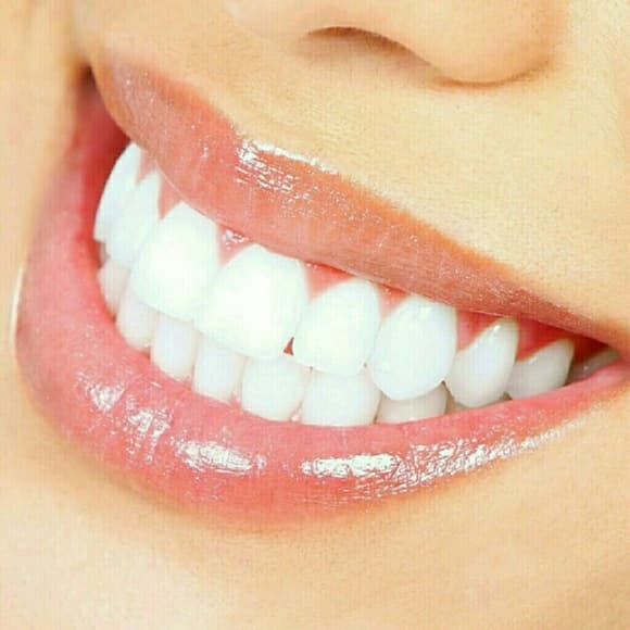 (2) Instant Teeth whitening Pens - Thumbnail 4