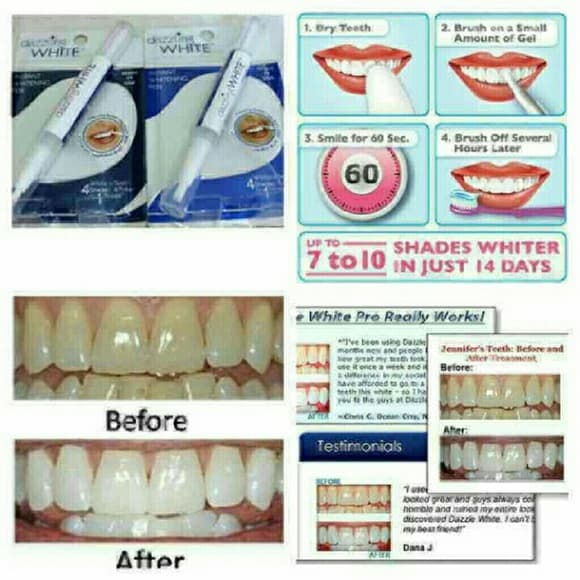 (2) Instant Teeth whitening Pens