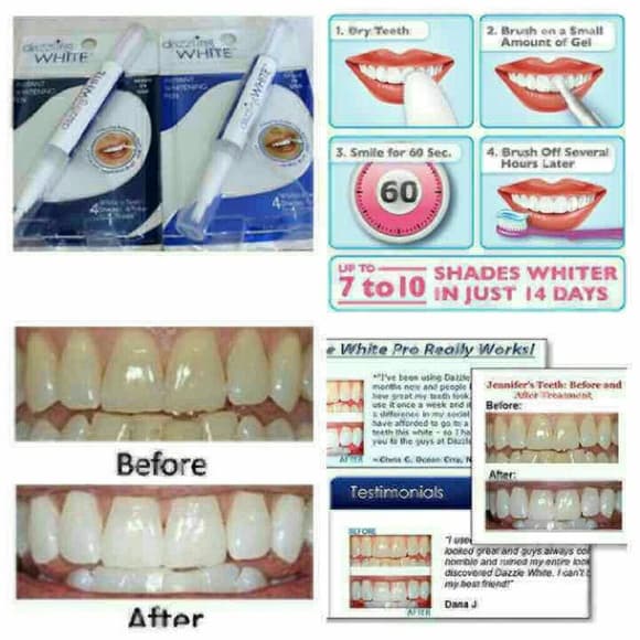 (X3) Instant Teeth Whitening Pens - Thumbnail 3