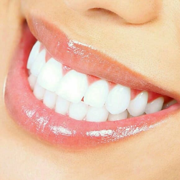 (X3) Instant Teeth Whitening Pens