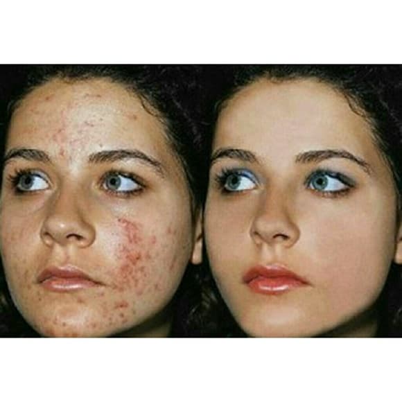 💖💖 SALE Dark Spot Remover-Ultimate Age-Defy💖💖 - Thumbnail 3
