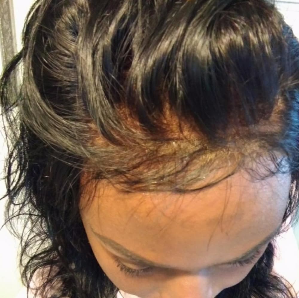 Virgin Brazilian 360 Lace Band Frontal 14 inches - Thumbnail 8