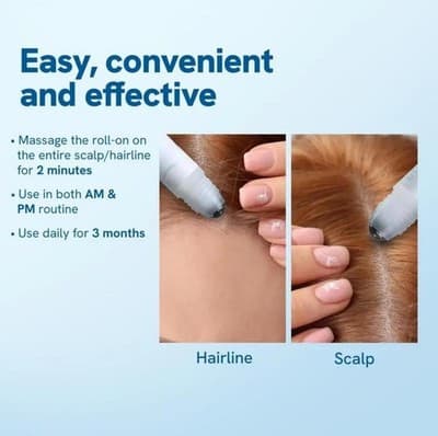 Hair Growth Serum Roll On – Thicker, Stronger Hair Faster - Thumbnail 6