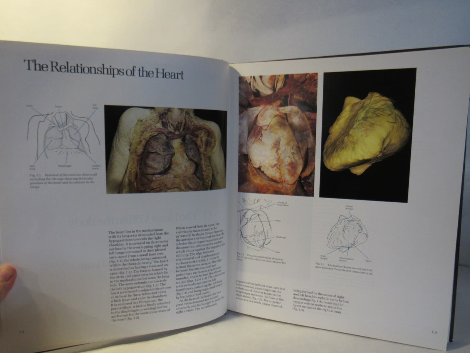 CARDIAC Anatomy: AN INTEGRAL TEXT AND COLOUR ATLAS By Robert H. Anderson Q30J - Thumbnail 5