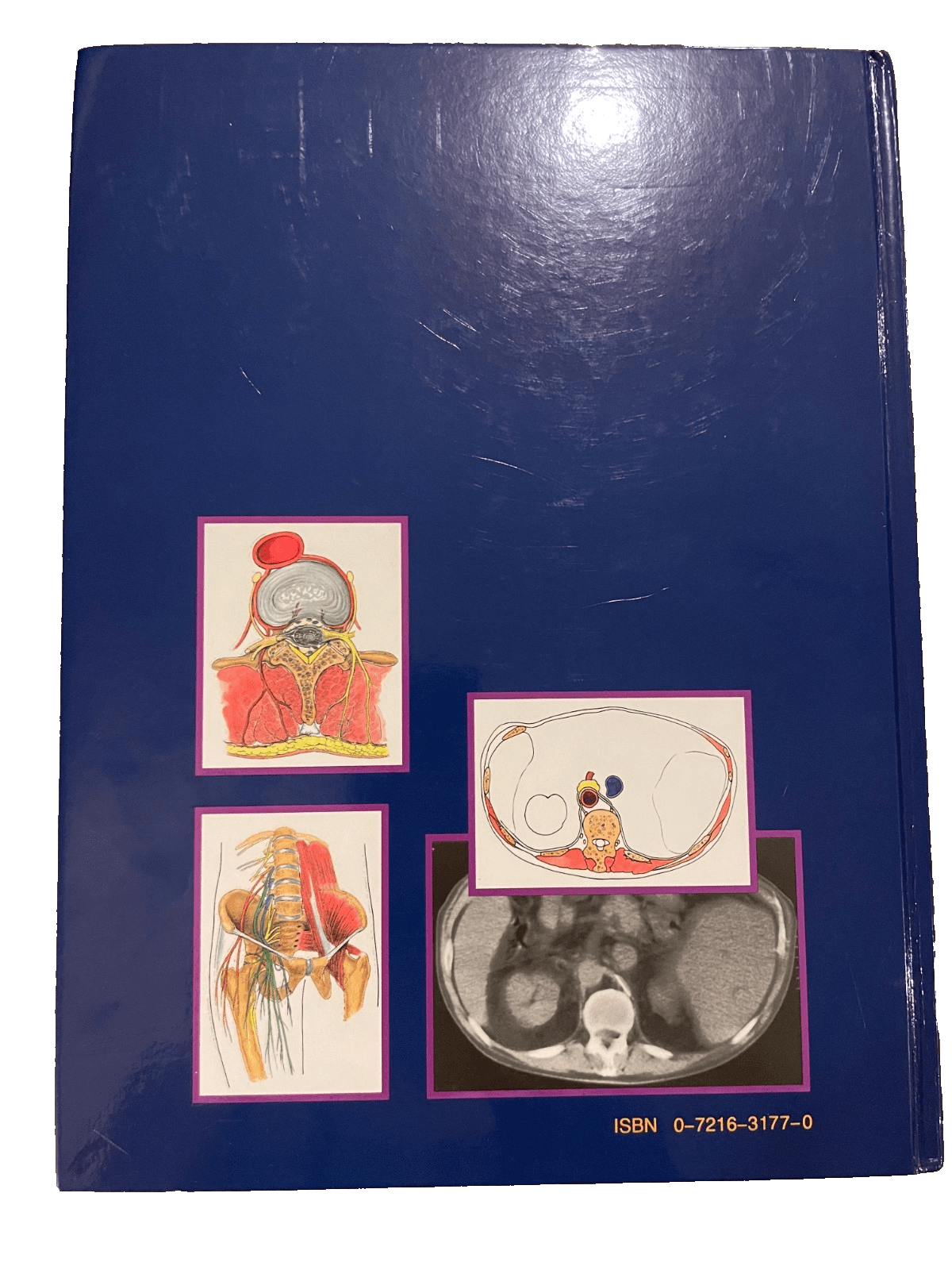Atlas of Regional Anesthesia by David L. Brown (1991 Hardcover) Medical Textbook - Thumbnail 2