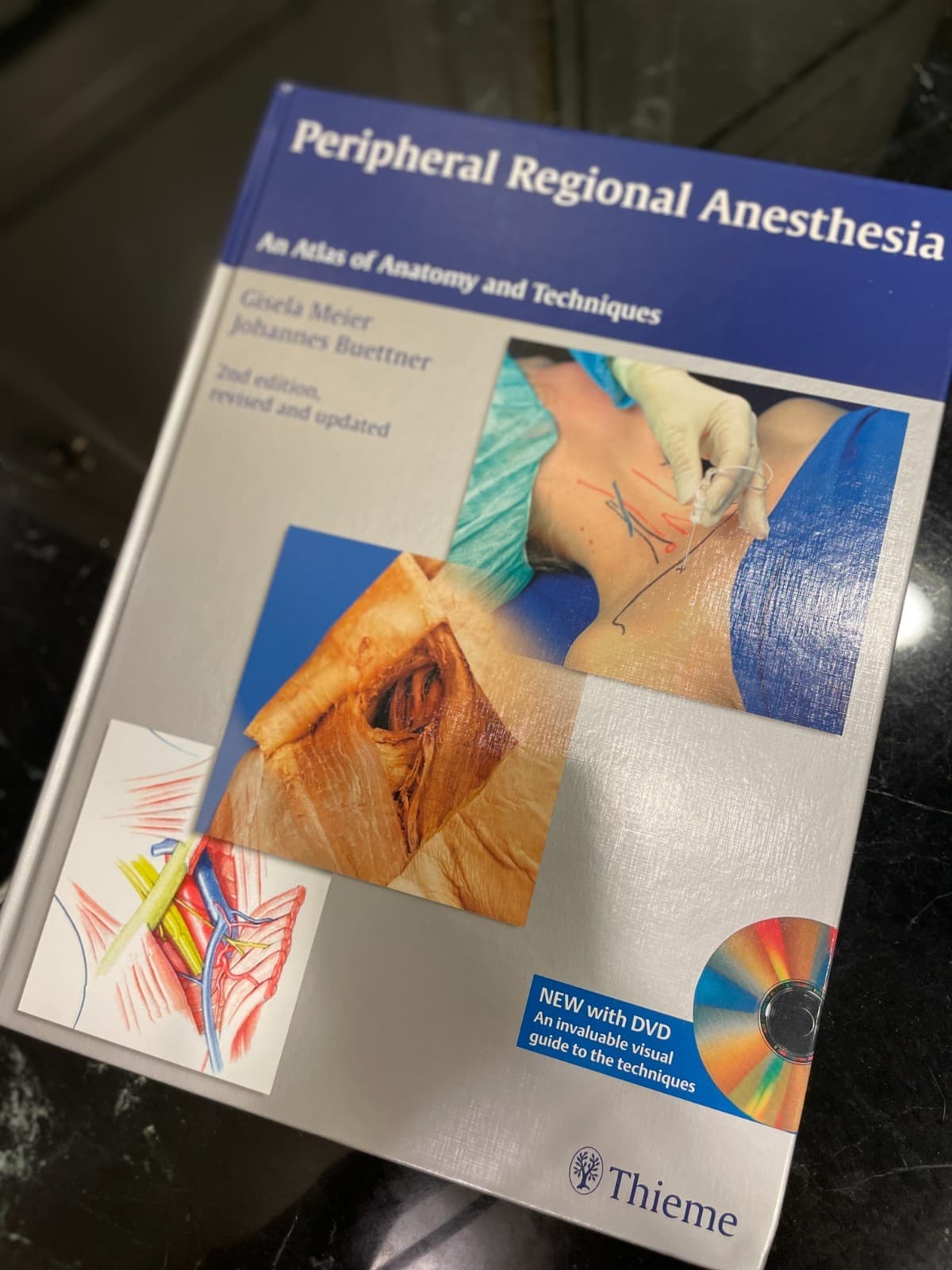 Peripheral Regional Anesthesia: Atlas of Anatomy and Techniques-Meier-2nd Ed - Thumbnail 3