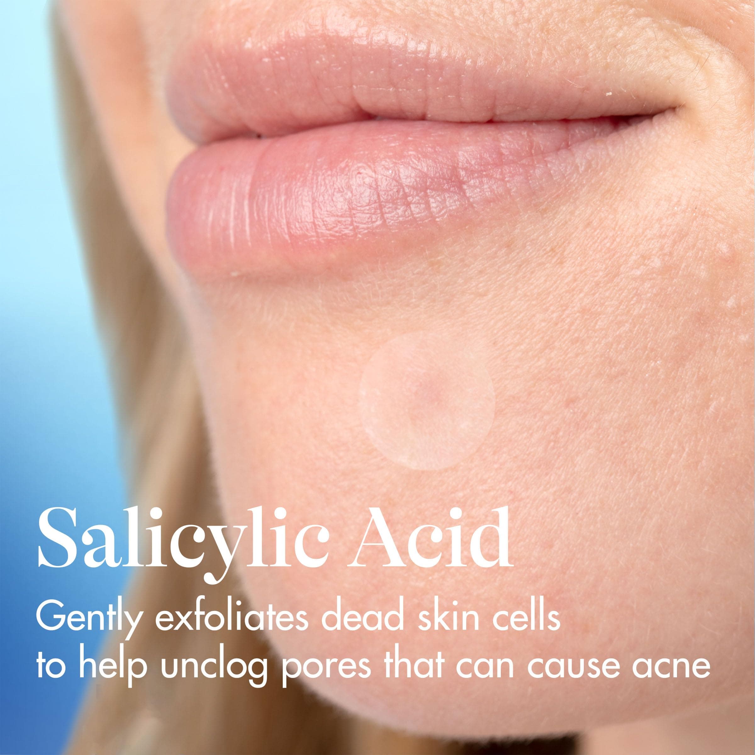 Differin Acne Fighter Pack Salicylic Acid Pimple Patches 36 Count Acne Treatment - Thumbnail 6