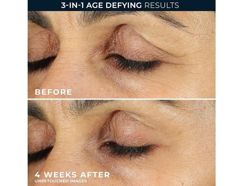 RoC Retinol Correxion Line Smoothing Eye Cream, 0.5 fl oz (15 ml) - Thumbnail 6