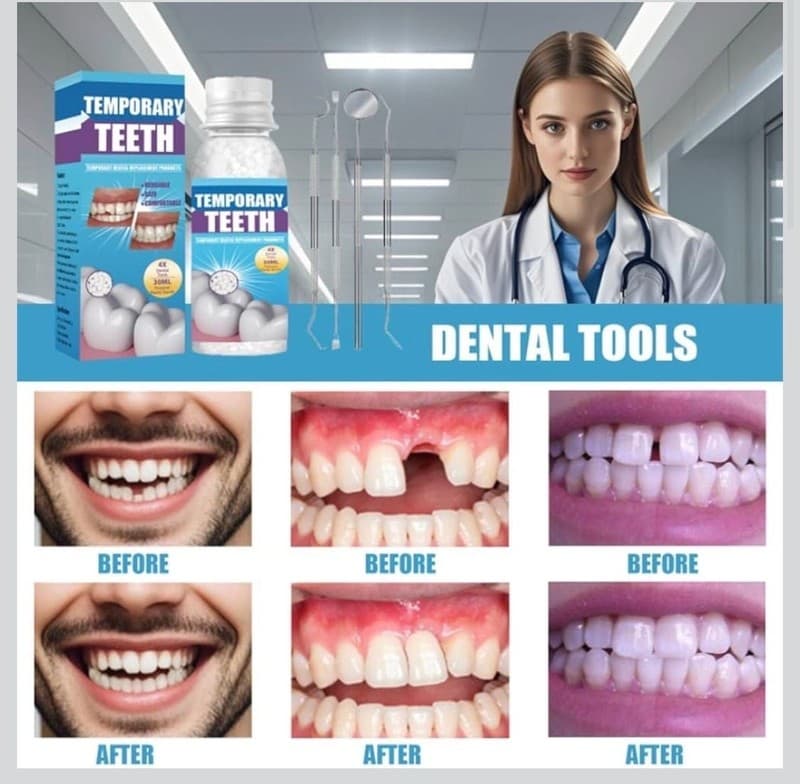 30ml Temporary Tooth Repair Kit with 4-Piece Dental Tool Set and Moldable Therma - Thumbnail 2