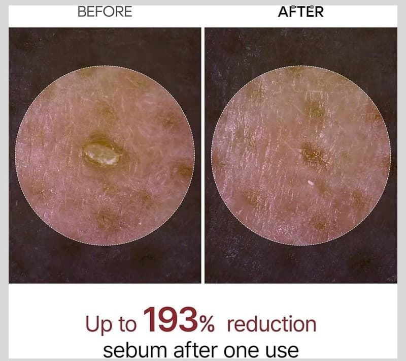 Dr.Melaxin Peel Shot Exfoliating White Rice Ampoule 80ml - Thumbnail 3