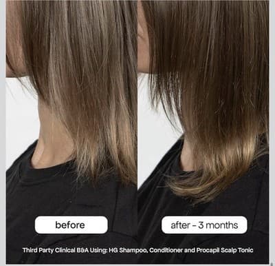 BondiBoost HG Procapil Scalp Tonic – 4.23 fl oz - Thumbnail 6