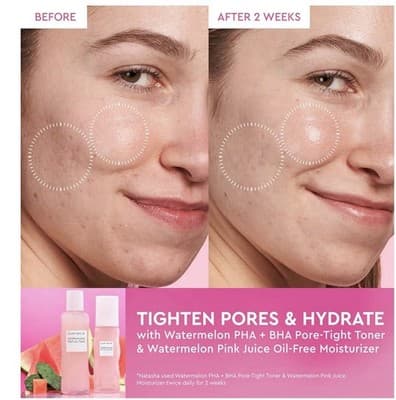 Glow Recipe Watermelon Glow PHA + BHA Pore-Tight Toner 40 mL / 1.35 fl oz Mini - Thumbnail 3
