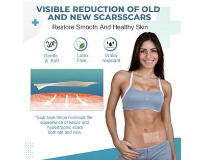⭐ Silicone Scar Sheets – Professional Medical-Grade Scar Tape ⭐ - Thumbnail 6