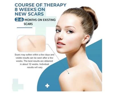 ⭐ Silicone Scar Sheets – Professional Medical-Grade Scar Tape ⭐ - Thumbnail 8