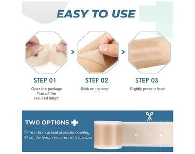 ⭐ Silicone Scar Sheets – Professional Medical-Grade Scar Tape ⭐ - Thumbnail 7