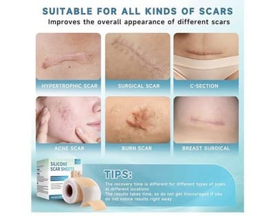 ⭐ Silicone Scar Sheets – Professional Medical-Grade Scar Tape ⭐ - Thumbnail 4