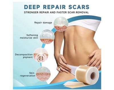 ⭐ Silicone Scar Sheets – Professional Medical-Grade Scar Tape ⭐ - Thumbnail 2
