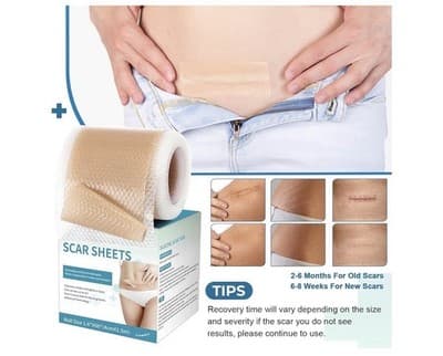 ⭐ Silicone Scar Sheets – Professional Medical-Grade Scar Tape ⭐ - Thumbnail 5
