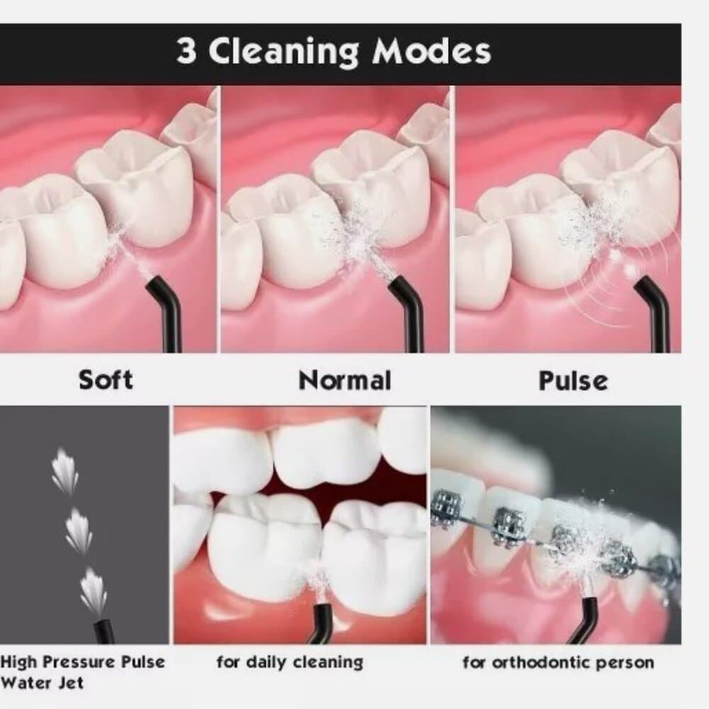 MOSPRO – Cordless Water Flosser Dental Oral Irrigator – Water Flosser – Teeth Cl - Thumbnail 4