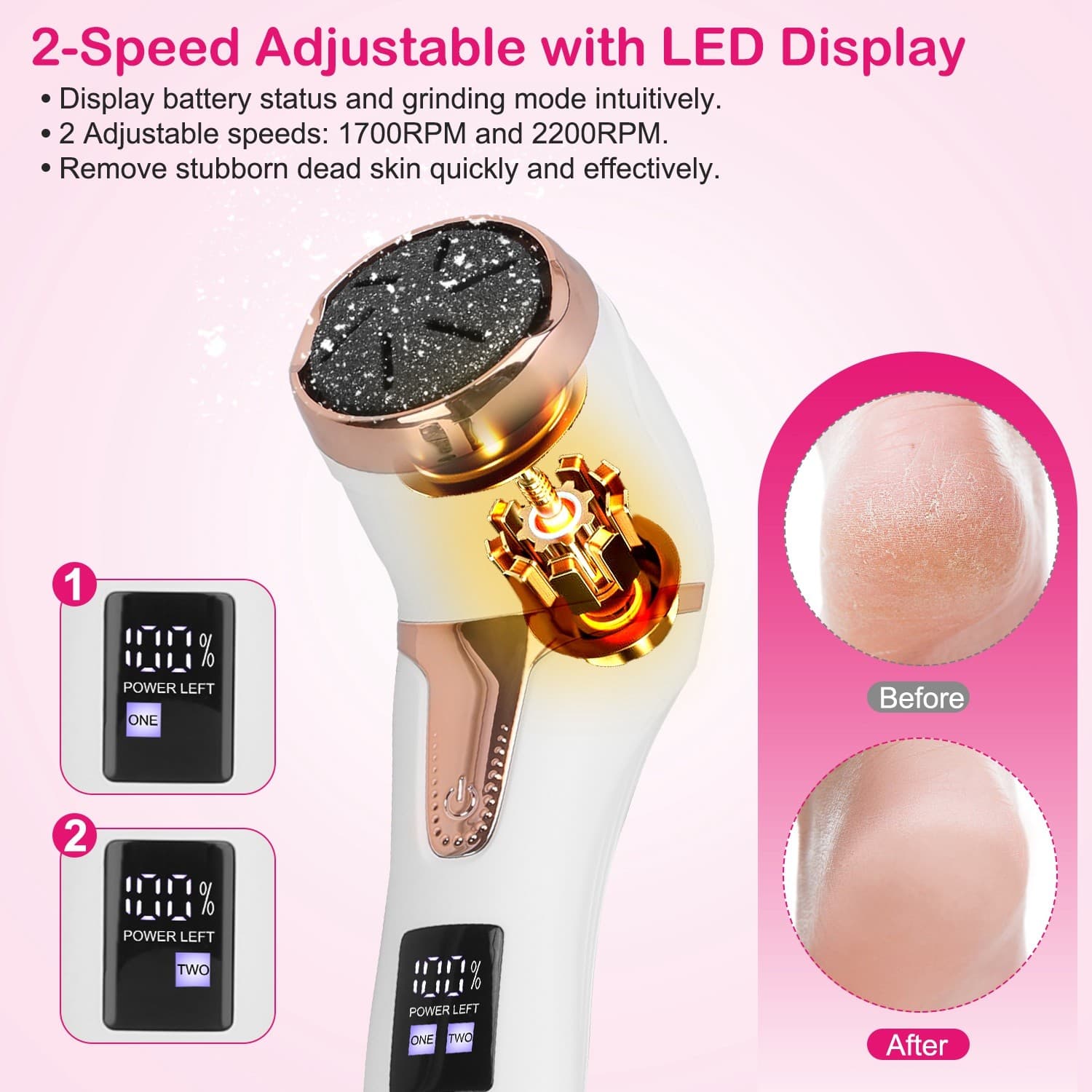 17Pcs Electric Foot Callus Remover With Vacuum Foot Grinder Rechargeable Foot Fi - Thumbnail 5