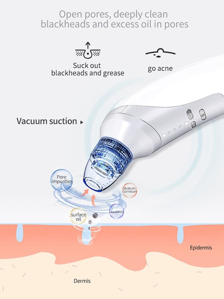 Blackhead Suction Instrument, Electric Blackhead Suction Artifact, Blackhead Rem - Thumbnail 5