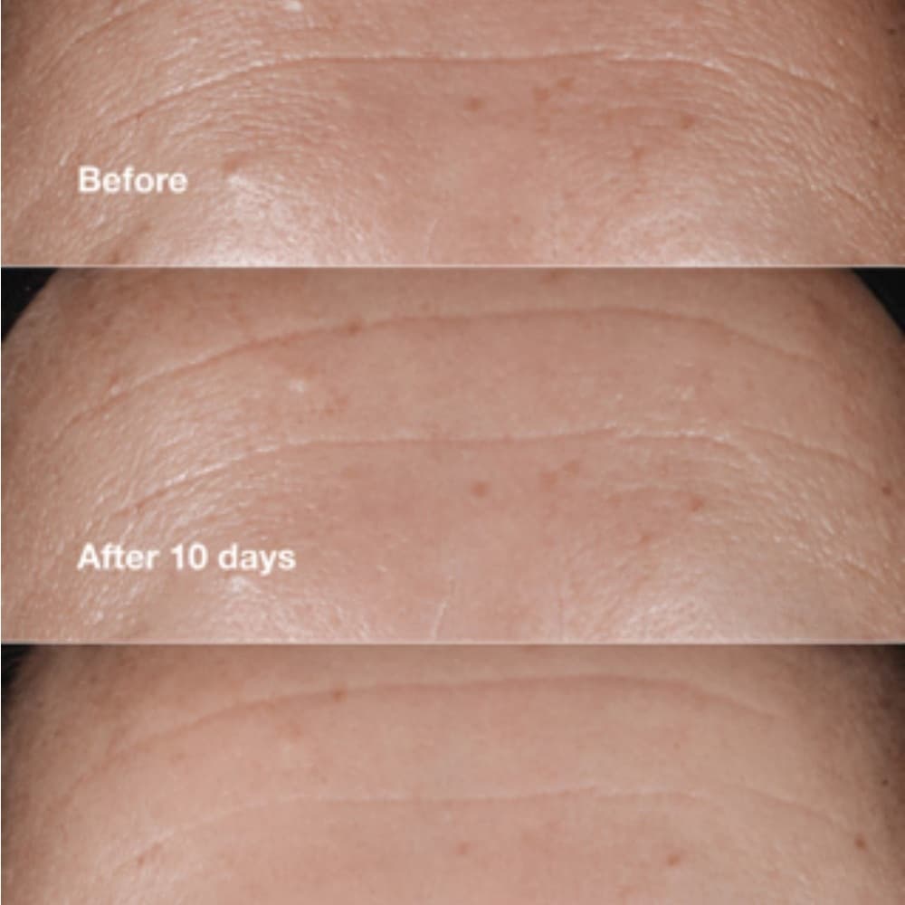 Clinique Smart Clinical Repair Cream and Mask - Thumbnail 4