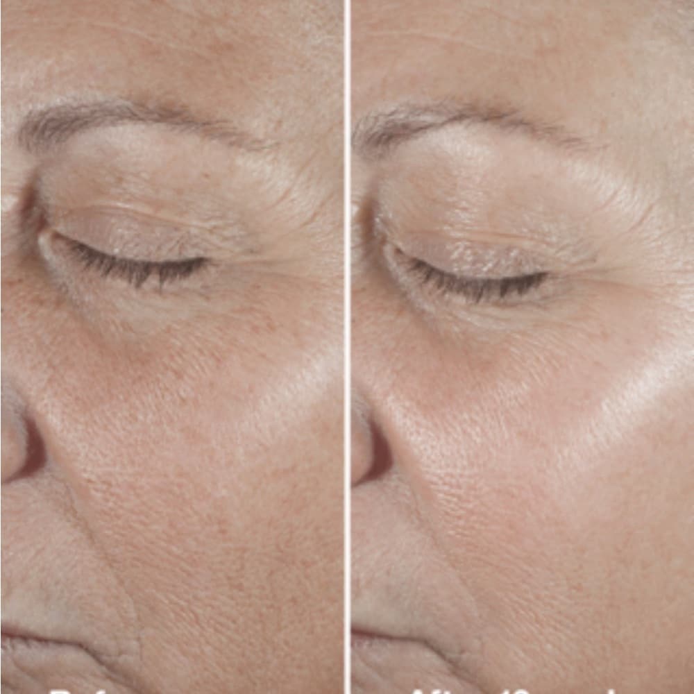 Clinique Smart Clinical Repair Cream and Mask - Thumbnail 3
