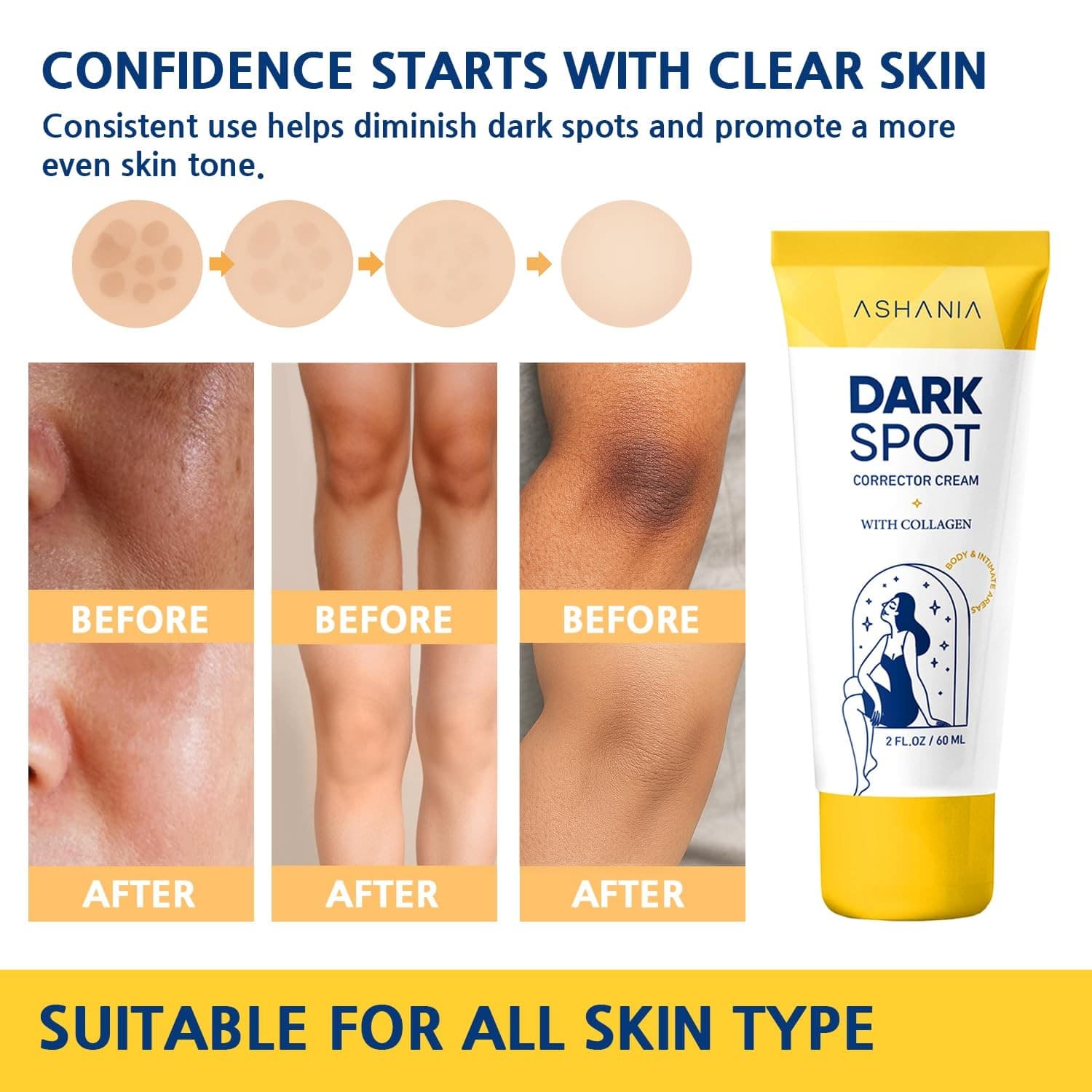 Dark Spot Corrector Cream Face & Body with Collagen 2oz - Thumbnail 5