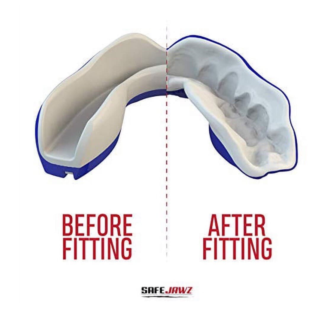 Safejawz Extro Series Shark Gum Shield Blue Mouth Protection Guard Boxing MMA - Thumbnail 5