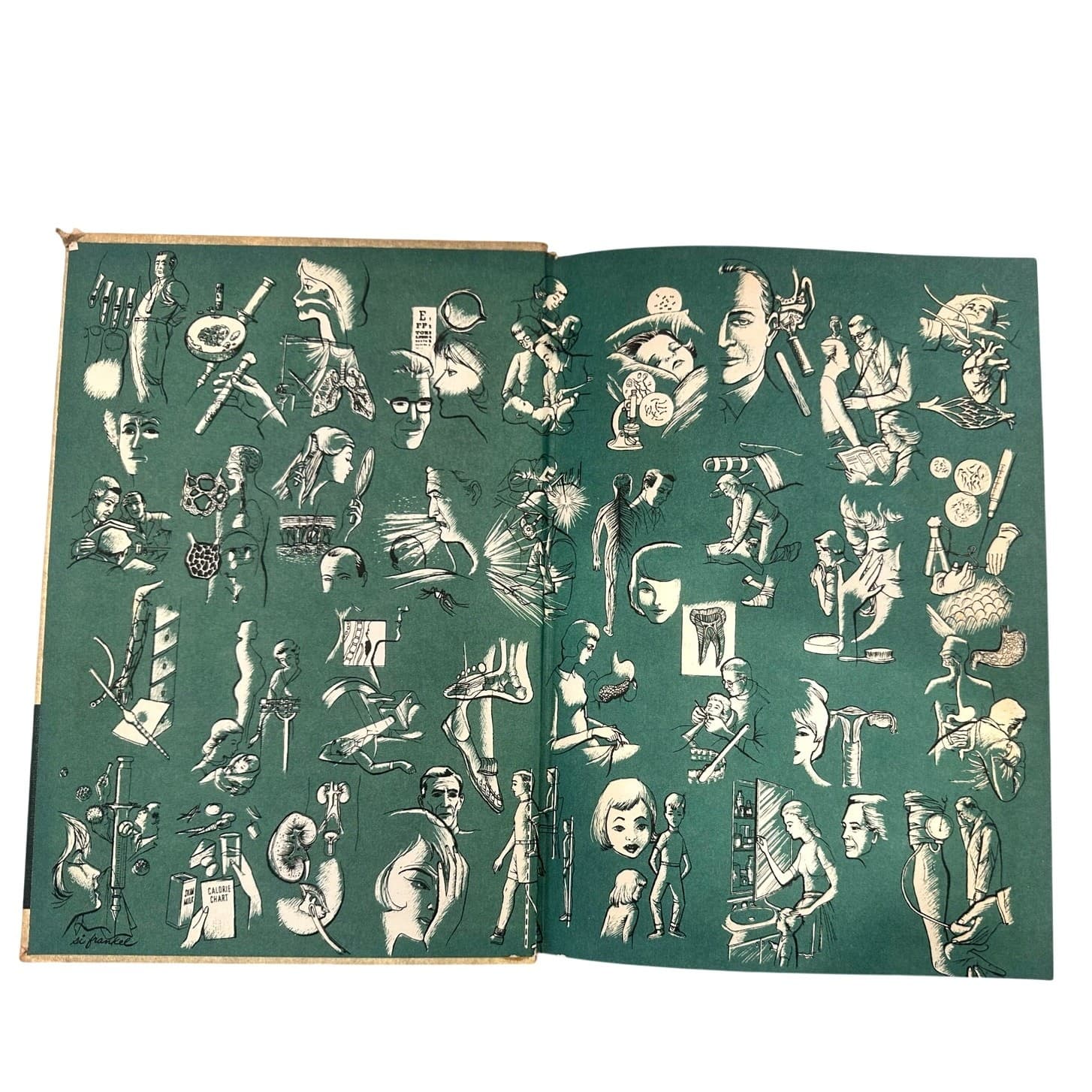The New Illustrated Medical & Health Encyclopedia 1964 Complete Set Volumes 1-14 - Thumbnail 5