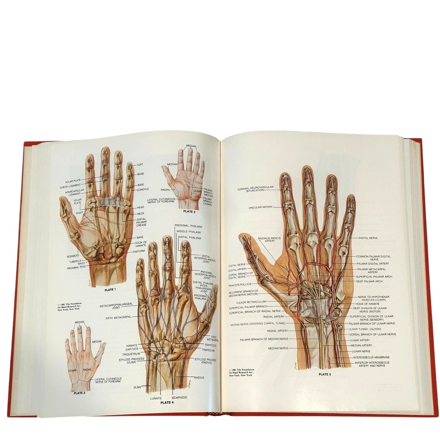 Hand Injuries Robert W. Beasley MD 1981 Hardback - Thumbnail 3