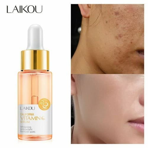 Whitening Antioxidant Remove Spots Firm Soothing Brighten Vitamin C Serum 15ml - Image 1