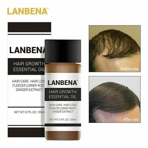 Unisex Lanbena Hair Loss Treatment Ginger Extract Hair Growth Essential Oil 20ml - Image 1