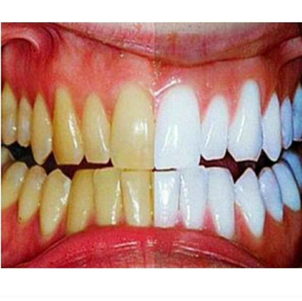 (2) Instant Teeth Whitening Pen