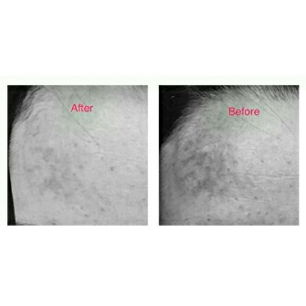 Double Strength Night Serum-Get Clear Skin!!