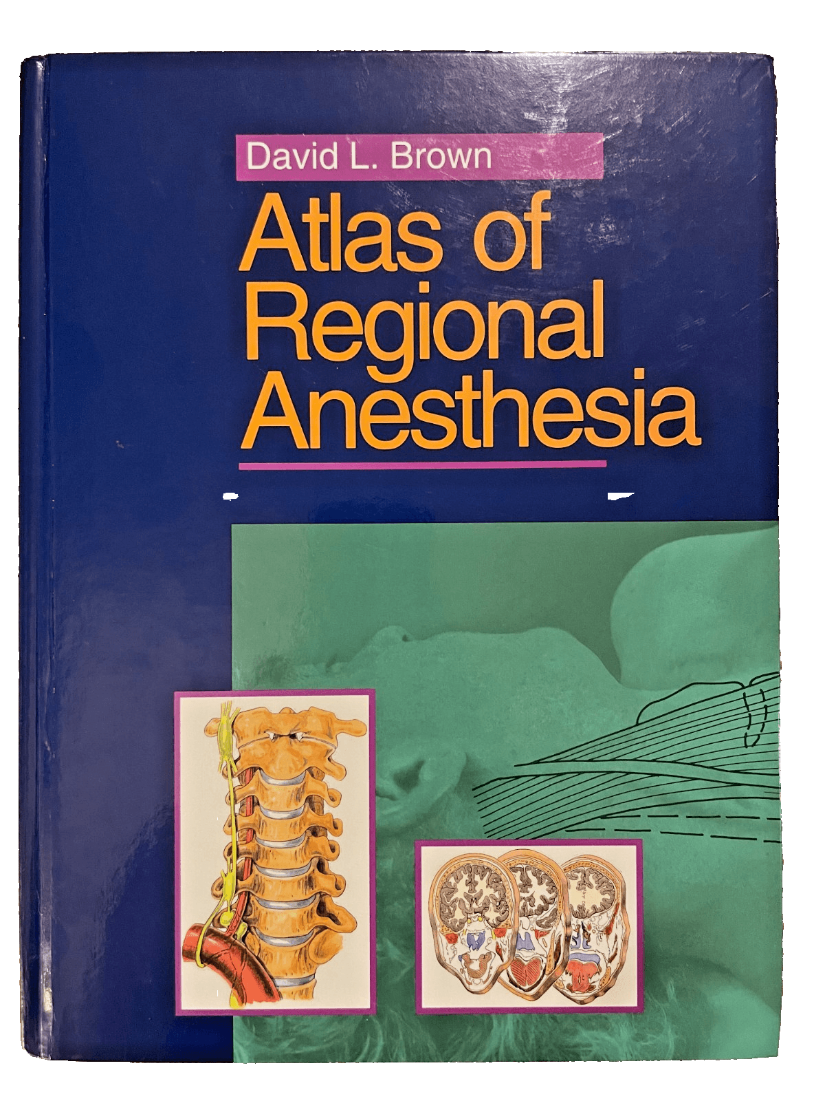Atlas of Regional Anesthesia by David L. Brown (1991 Hardcover) Medical Textbook