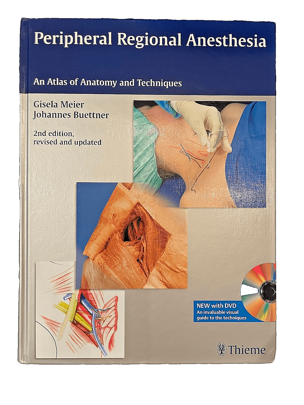 Peripheral Regional Anesthesia: Atlas of Anatomy and Techniques-Meier-2nd Ed